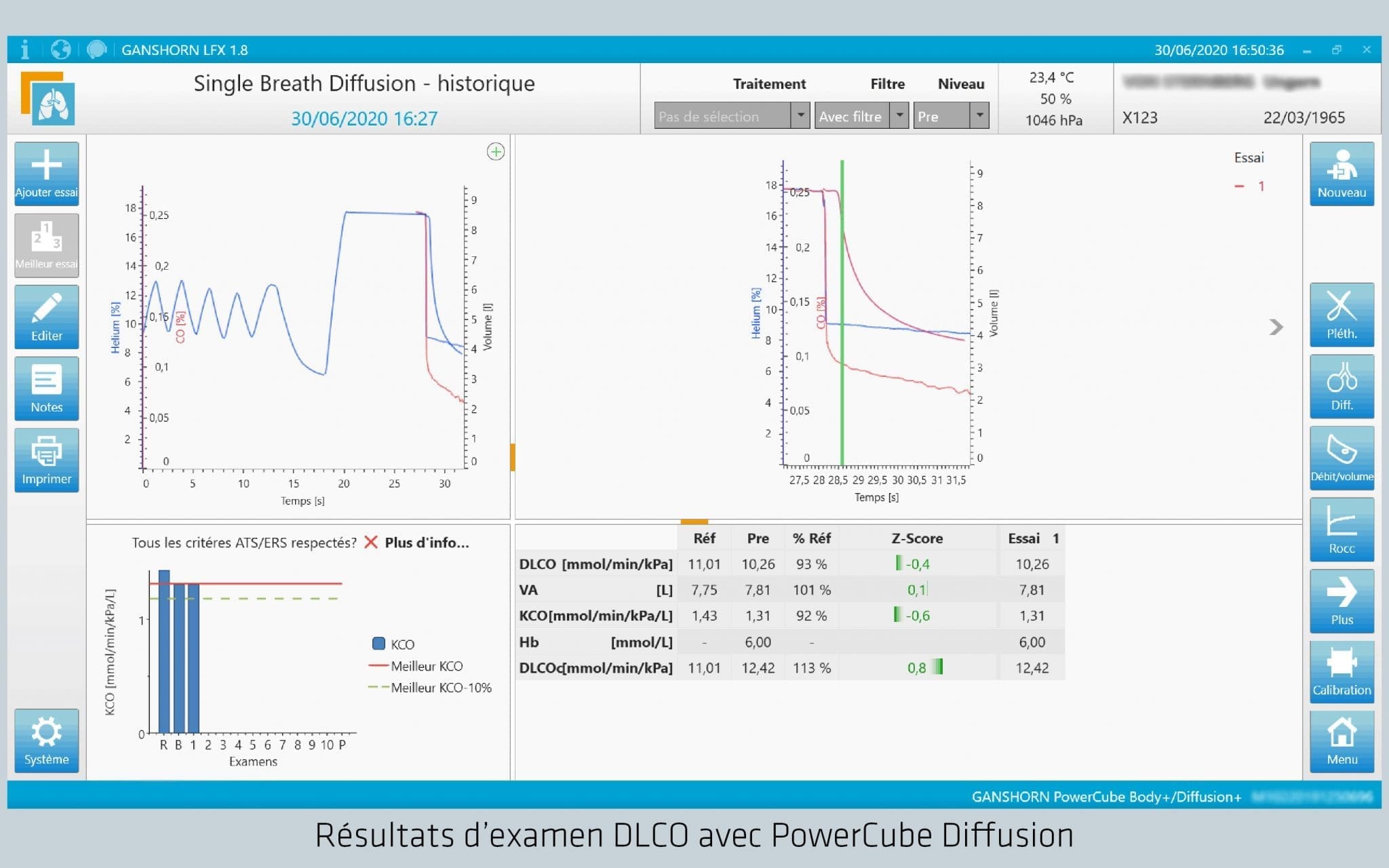 Résultats d’examen DLCO avec PowerCube Diffusion