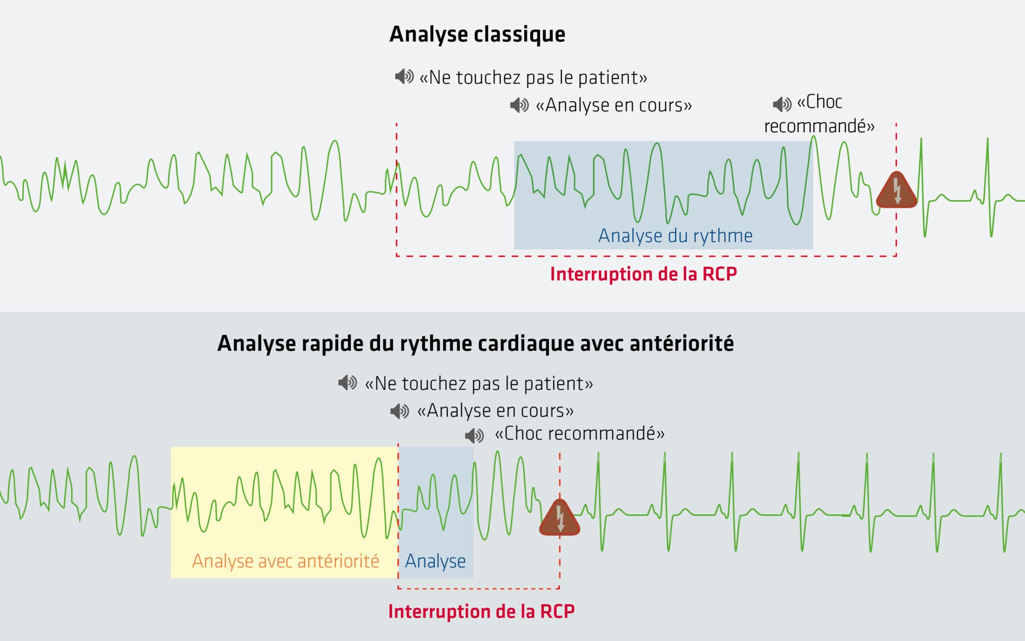 défibrillateur Analyse rapide du rythme cardiaque avec antériorité
