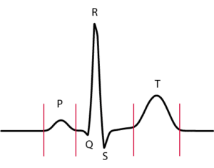 Schéma de l'onde électrique du cœur représenté par un PQRST