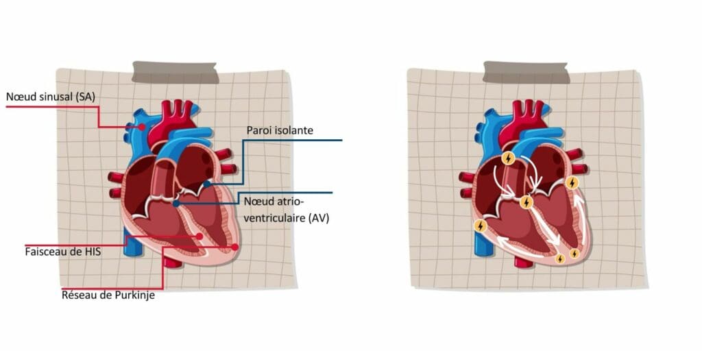 Schémas du cœur pour représenter le rythme cardiaque. 